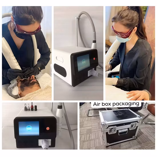 Лазер ND YAG с модуляцией добротности для удаления татуировок, портативный пикосекундный лазер